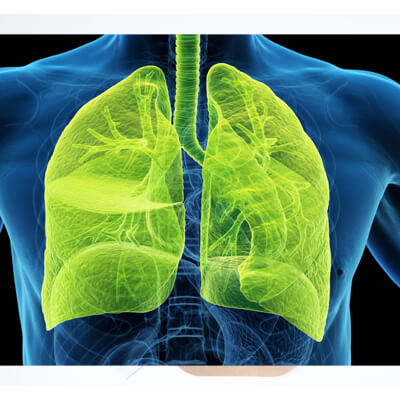 Diet and Nutrition for Cystic Fibrosis: Tailoring Your Intake for Optimal Health