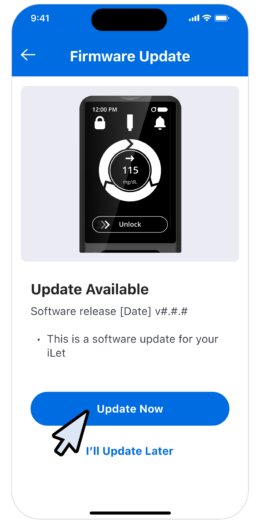Step 4: When an update is available, tap Update Now.